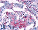 FZD3 / Frizzled 3 Antibody - Breast, Carcinoma