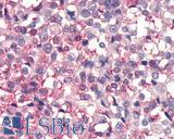 FZD4 / Frizzled 4 Antibody - Breast, Carcinoma