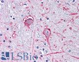 GABRA3 Antibody - Anti-GABRA3 antibody IHC of human brain, globus pallidus. Immunohistochemistry of formalin-fixed, paraffin-embedded tissue after heat-induced antigen retrieval.