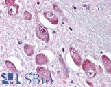 GABRA3 Antibody - Anti-GABRA3 antibody IHC of human brain, basal nucleus of Meynert. Immunohistochemistry of formalin-fixed, paraffin-embedded tissue after heat-induced antigen retrieval.