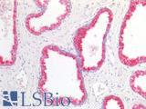 GDF15 Antibody - Human Prostate: Formalin-Fixed, Paraffin-Embedded (FFPE)