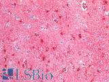 GFAP Antibody - Human Brain, Cortex: Formalin-Fixed, Paraffin-Embedded (FFPE)
