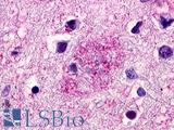 GPR119 Antibody - Brain, Alzheimer's Disease, Senile plaque