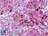 GPR12 Antibody - Skin, melanoma
