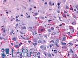 GPR137B Antibody - Brain, glioblastoma
