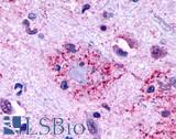 GPR146 Antibody - Brain, Alzheimer's disease, senile plaque