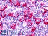 GPR152 Antibody - Hodgkin's lymphoma