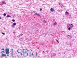 GPR160 Antibody - Brain, Alzheimer's disease senile plaque