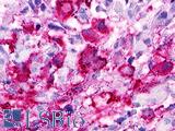 GPR173 / SREB3 Antibody - Brain, Glioblastoma