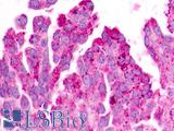 GPR183 / EBI2 Antibody - Ovary, Carcinoma