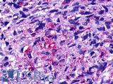 GPR19 Antibody - Brain, Glioblastoma
