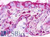 GPR26 Antibody - Lung, non small-cell carcinoma