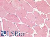 GPR49 / LGR5 Antibody - Human Skeletal Muscle: Formalin-Fixed, Paraffin-Embedded (FFPE)