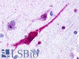 GPR62 Antibody - Brain, Temporal cortex, neurons