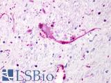 GPR62 Antibody - Brain, substantai nigra, nonpigmented neurons and glia