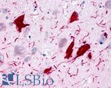 GPR78 Antibody - Brain, Alzheimer's disease, neurofibrillary tangles