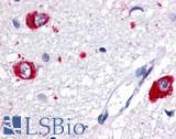 GPR83 Antibody - Brain, Thalamus, neurons