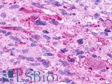 GPR84 Antibody - Brain, Glioblastoma