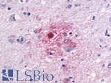 GPR87 Antibody - Brain, Alzheimer's disease senile plaque