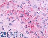 GRM3 / MGLUR3 Antibody - Brain, glioblastoma