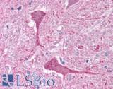 GRM3 / MGLUR3 Antibody - Brain, Medulla