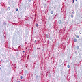 GRM4 / MGLUR4 Antibody - Brain, Substantia nigra white matter