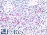 Hairy Cell Leukemia Antibody - Human Spleen: Formalin-Fixed, Paraffin-Embedded (FFPE)