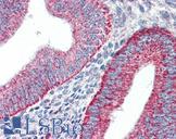 HAVCR1 / KIM-1 Antibody - Anti-TIM-1 antibody IHC of human uterus, endometrium. Immunohistochemistry of formalin-fixed, paraffin-embedded tissue after heat-induced antigen retrieval. Antibody concentration 5 ug/ml.