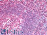 HCLS1 Antibody - Human Tonsil: Formalin-Fixed, Paraffin-Embedded (FFPE)