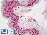 HES5 Antibody - Human Skin: Formalin-Fixed, Paraffin-Embedded (FFPE)