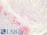HNE / Neutrophil Elastase Antibody - Human Thymus: Formalin-Fixed, Paraffin-Embedded (FFPE)