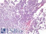 HNE / Neutrophil Elastase Antibody - Human Thymus: Formalin-Fixed, Paraffin-Embedded (FFPE)