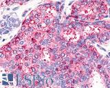 HNF4G / HNF4 Gamma Antibody - Breast carcinoma