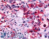 HRH4 / Histamine H4 Receptor Antibody - Lung, Non Small-Cell Carcinoma