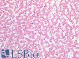 HSD17B12 Antibody - Human Liver: Formalin-Fixed, Paraffin-Embedded (FFPE)
