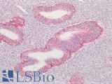HSPD1 / HSP60 Antibody - Human Uterus: Formalin-Fixed, Paraffin-Embedded (FFPE)