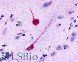 HTR6 / 5-HT6 Receptor Antibody - Brain, Basal Ganglia