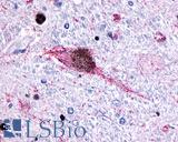 HTR6 / 5-HT6 Receptor Antibody - Brain, Substantia Nigra