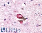 HTR7 / 5HT7 Receptor Antibody - Brain, Parkinson's Lewy Body