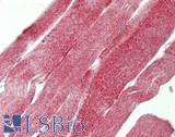 HTRA2 / OMI Antibody - Human Skeletal Muscle: Formalin-Fixed, Paraffin-Embedded (FFPE)