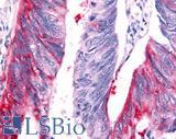 HUNK / B19 Antibody - Colon, Carcinoma