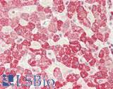 IDE Antibody - Human Liver: Formalin-Fixed, Paraffin-Embedded (FFPE)