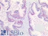 IGF2 Antibody - Human Prostate: Formalin-Fixed, Paraffin-Embedded (FFPE)