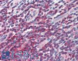 IL10RA Antibody - Human Small Intestine, MALT: Formalin-Fixed, Paraffin-Embedded (FFPE), at a concentration of 10 ug/ml. 