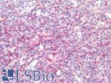 IL17A Antibody - Human Tonsil: Formalin-Fixed, Paraffin-Embedded (FFPE)