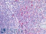 IL23R Antibody - Human Tonsil: Formalin-Fixed, Paraffin-Embedded (FFPE)