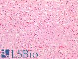IL6ST / CD130 / gp130 Antibody - Human Liver: Formalin-Fixed, Paraffin-Embedded (FFPE)
