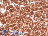 KRT18 / CK18 / Cytokeratin 18 Antibody - Human Pancreas: Formalin-Fixed, Paraffin-Embedded (FFPE)