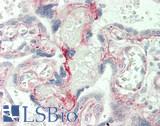 LAMC1 / Laminin Gamma 1 Antibody - Human Placenta: Formalin-Fixed, Paraffin-Embedded (FFPE)