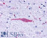 Leukotriene B4 Receptor / BLT1 Antibody - Brain, Thalamus, neurons and glia